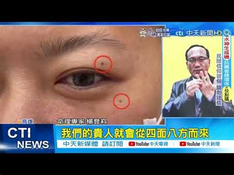 臉上有毛面相|臉長白毛位置暗示何事？